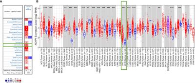 ACYP1 Is a Pancancer Prognostic Indicator and Affects the Immune Microenvironment in LIHC